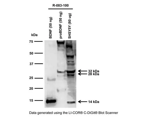 Anti-Brain-derived neurotrophic factor (BDNF) Antibody