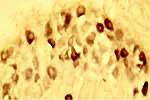 Anti-Brain-derived neurotrophic factor (BDNF) Antibody - Image 2