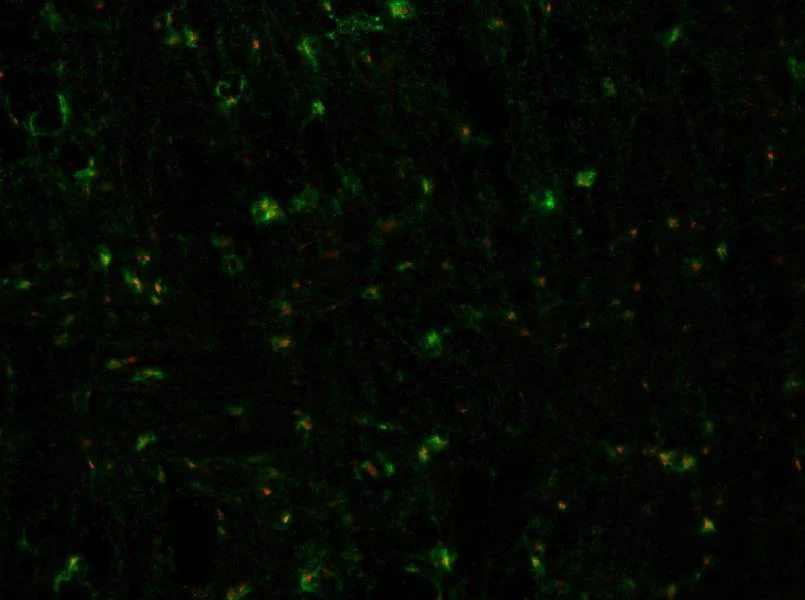 Anti-Bral1 Antibody
