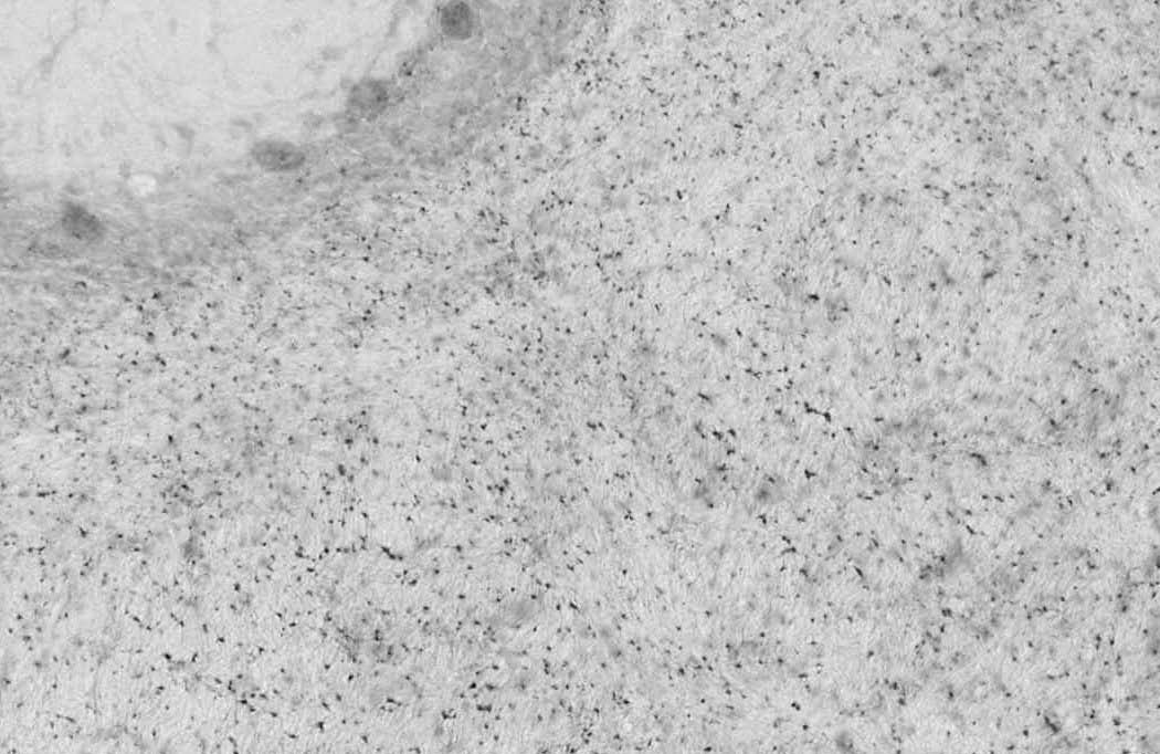 Anti-Bral1 Antibody - Image 3