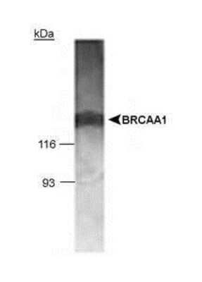 Anti-BRCAA1 Antibody