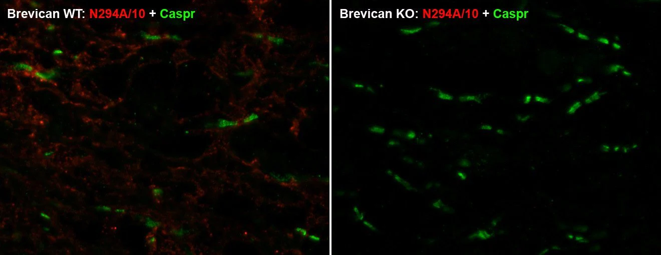 Anti-Brevican Antibody