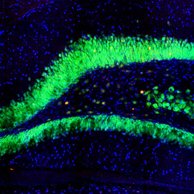 Anti-c-FOS Antibody - Image 2
