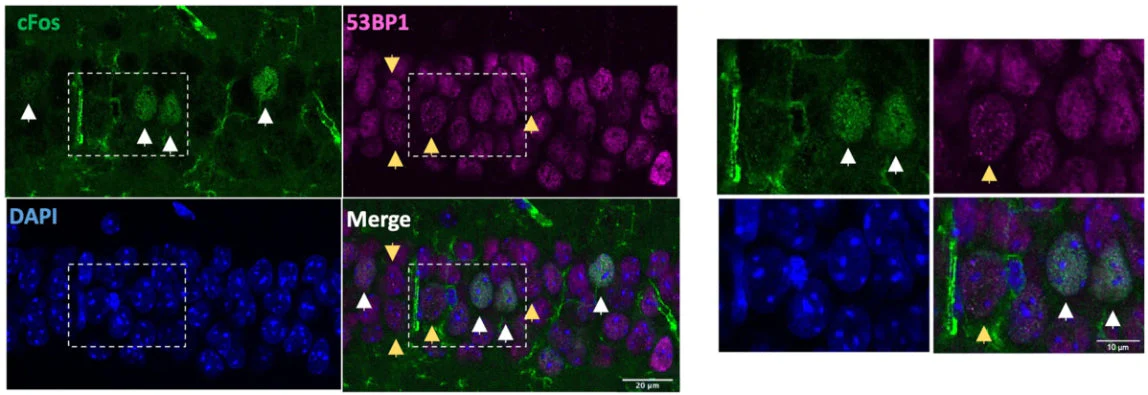 Anti-c-FOS Antibody - Image 5