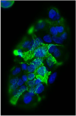 Anti-CA19-9/Sialyl Lewis A (sLeA) Antibody