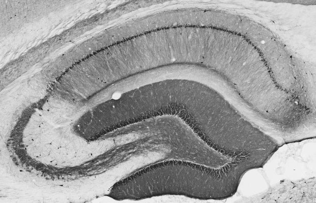 Anti-CALB1/calbindin Antibody - Image 2
