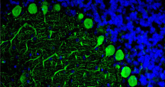 Anti-CALB1/Calbindin Recombinant Chicken Chimeric mAb - Image 4