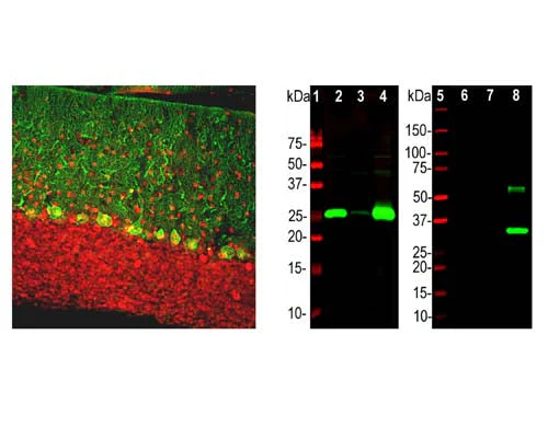 Anti-Calbindin Antibody - Image 2
