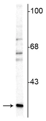Anti-Calretinin Antibody