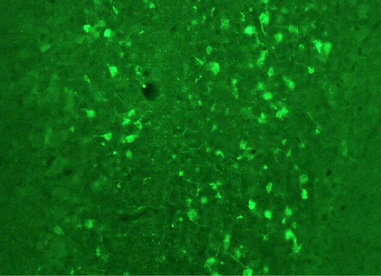 Anti-Calretinin Antibody - Image 2