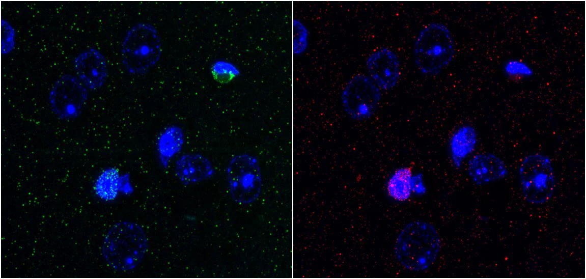 Anti-Calretinin Antibody