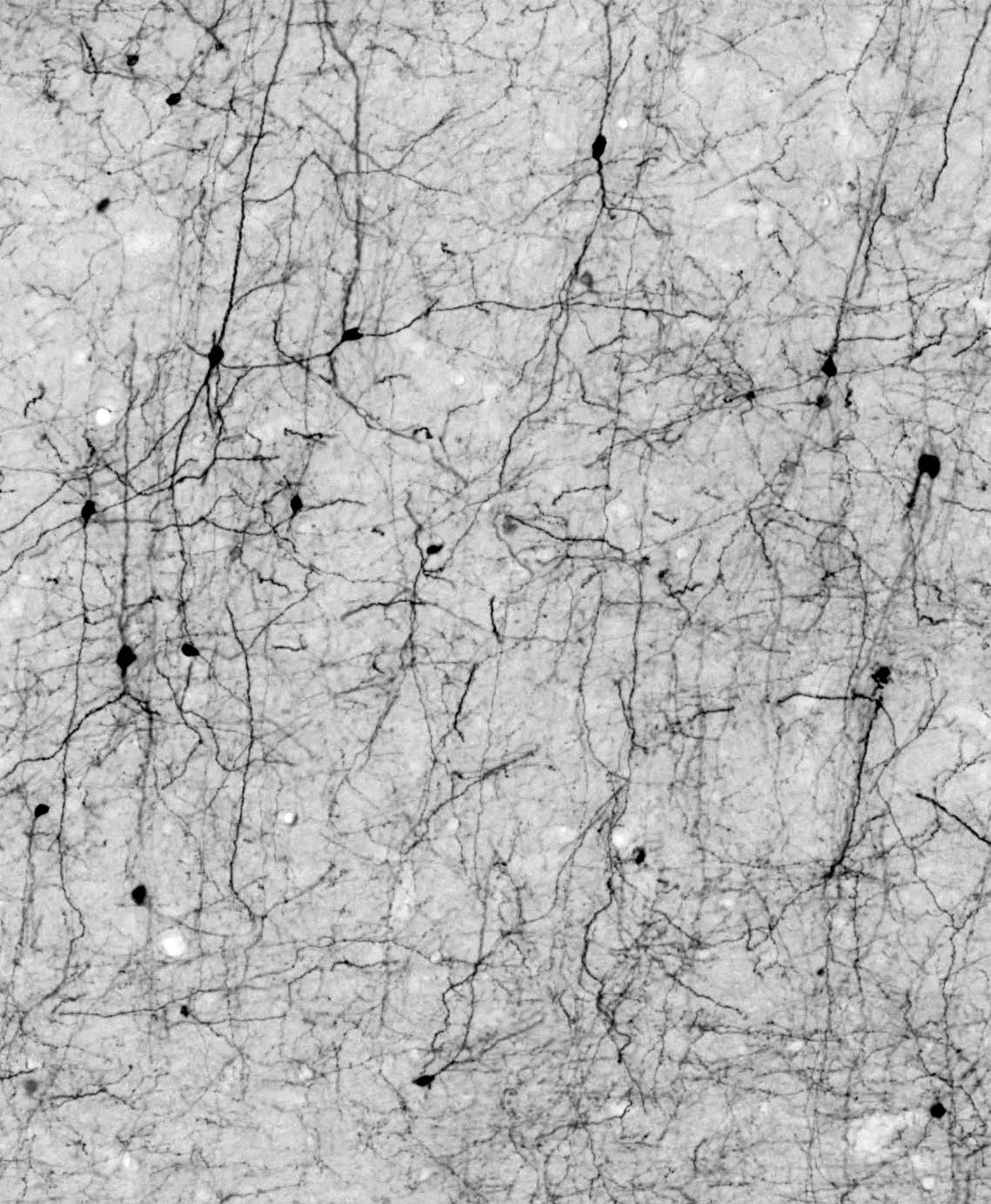 Anti-Calretinin Antibody - Image 2