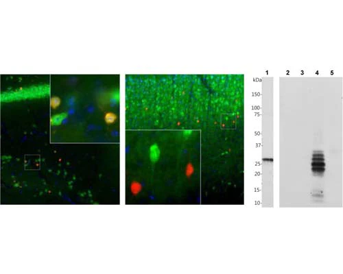 Anti-Calretinin-binding protein (CR) Antibody