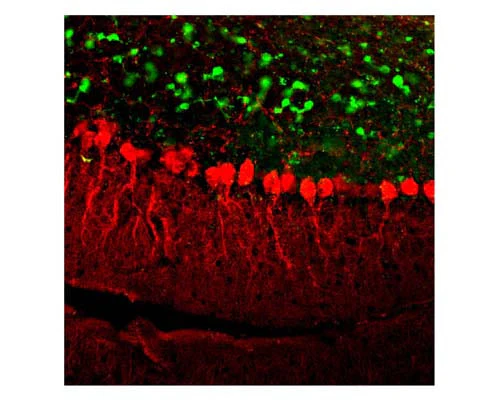Anti-Calretinin-binding protein (CR) Antibody - Image 2