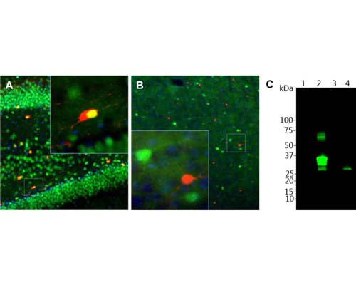 Anti-Calretinin (CR) Antibody