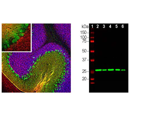 Anti-Calretinin (CR) Antibody