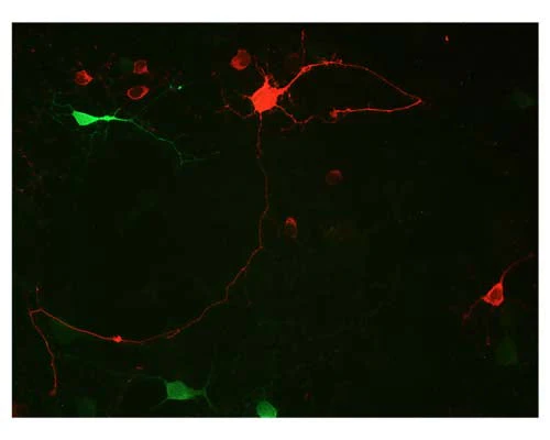 Anti-Calretinin (CR) Antibody - Image 3