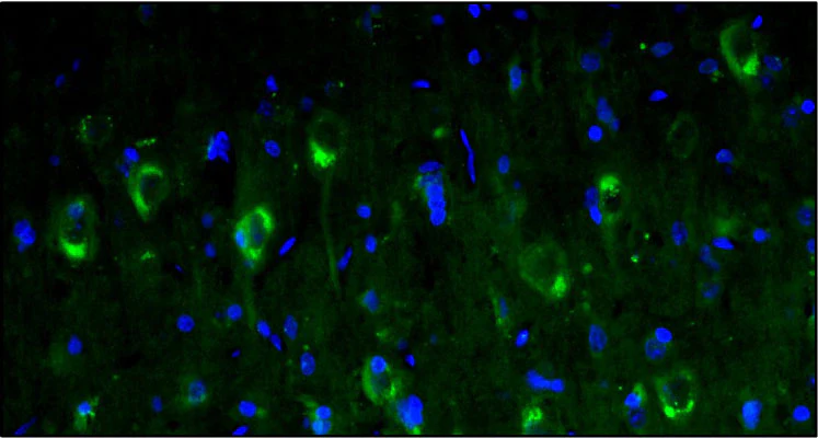 Anti-Calretinin Recombinant Chicken Chimeric mAb - Image 4