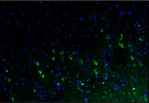 Anti-Calretinin Recombinant Chicken Chimeric mAb - Image 6