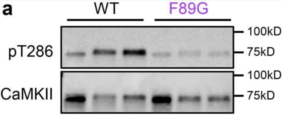 Anti-CaM Kinase II (Thr286) Antibody - Image 3