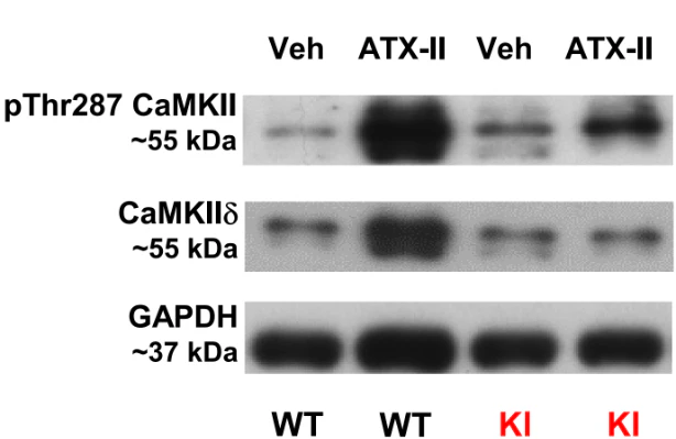 Anti-CaM Kinase II (Thr286) Antibody - Image 5