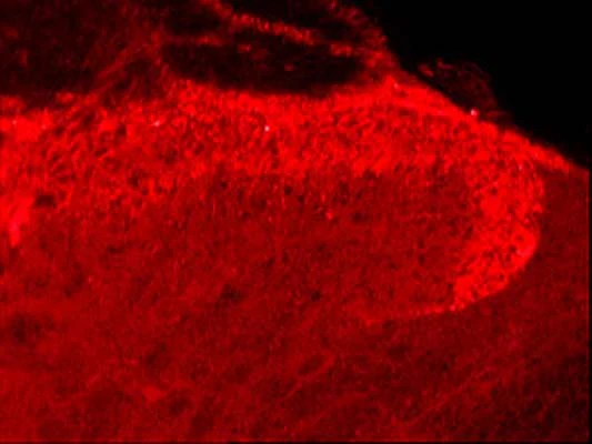 Anti-Capsaicin receptor (TrpV1) Antibody