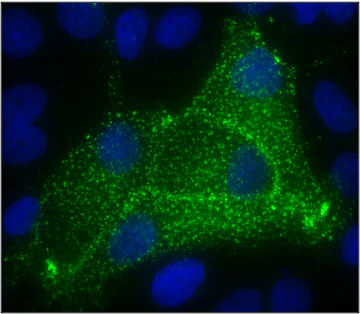 Anti-Carcinoembryonic Antigen (CEA) Antibody