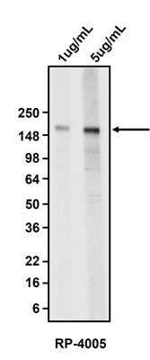 Anti-Carcinoembryonic Antigen (CEA) Antibody - Image 2