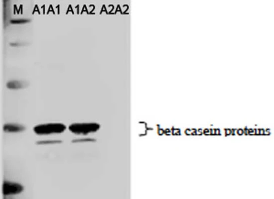 Anti-Casein, A1 beta Antibody