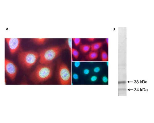 Anti-Casein kinase I isoform alpha (CKI-alpha) Antibody