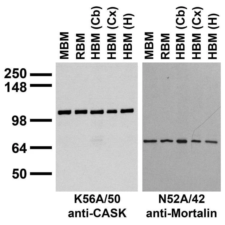 Anti-CASK Antibody - Image 3