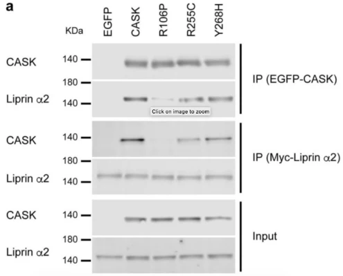 Anti-CASK Antibody - Image 4