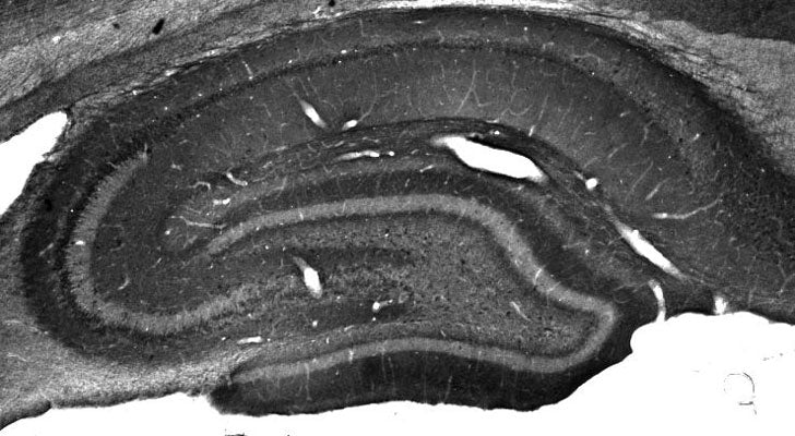Anti-CASPR/Neurexin IV Antibody - Image 2