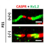 Anti-CASPR/Neurexin IV Antibody - Image 7