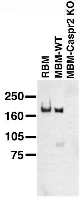 Anti-CASPR2 Antibody