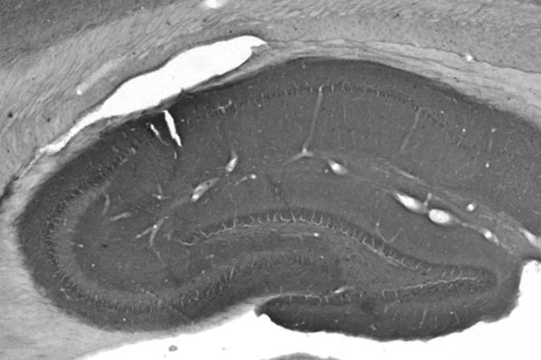 Anti-CASPR2 Antibody - Image 2