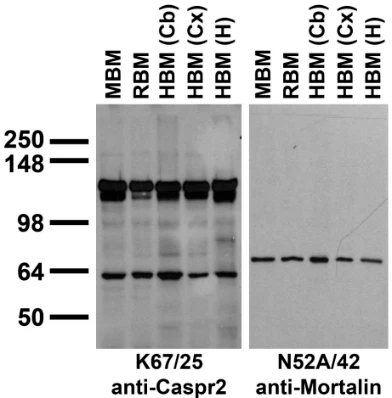 Anti-CASPR2 Antibody - Image 3