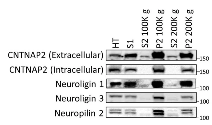 Anti-CASPR2 Antibody - Image 4