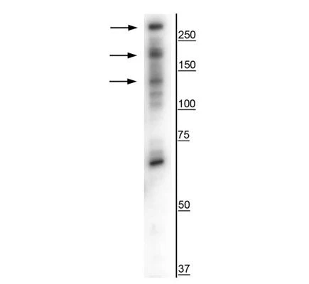 Anti-CaSR Antibody