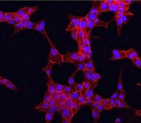 Anti-Catenin beta Antibody - Image 2