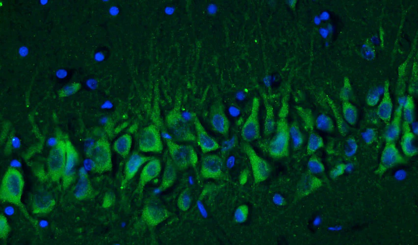 Anti-Cav1.2 Ca2+ Channel Recombinant Chicken Chimeric mAb