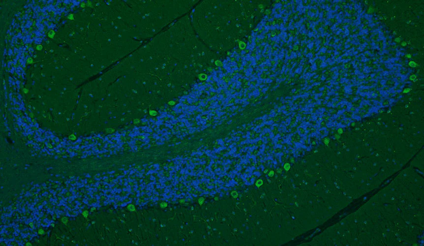 Anti-Cav1.2 Ca2+ Channel Recombinant Chicken Chimeric mAb - Image 3