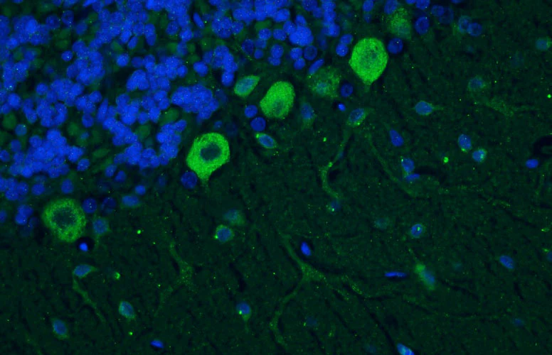 Anti-Cav1.2 Ca2+ Channel Recombinant Chicken Chimeric mAb - Image 4