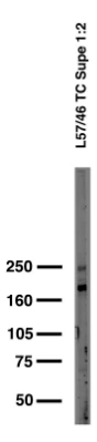 Anti-Cav1.2 Ca2+ Channel Antibody - Image 2