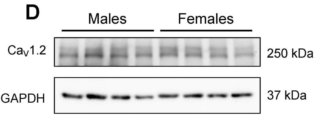 Anti-Cav1.2 Ca2+ Channel Antibody - Image 3
