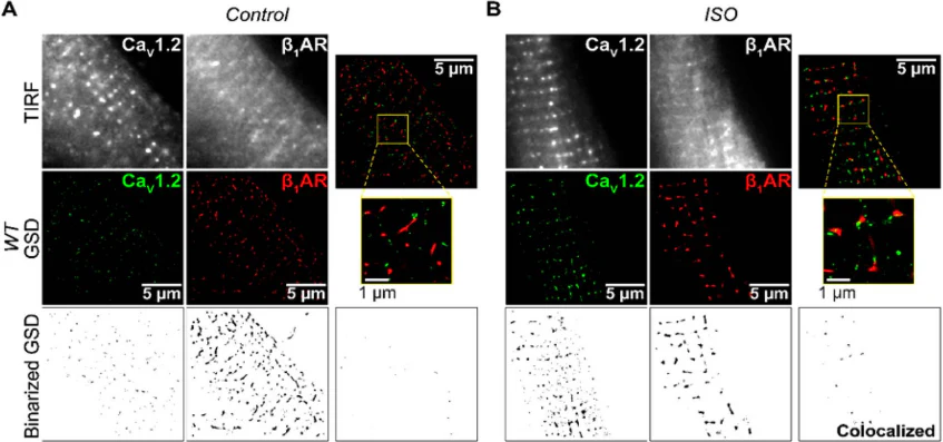 Anti-Cav1.2 Ca2+ Channel Antibody - Image 2