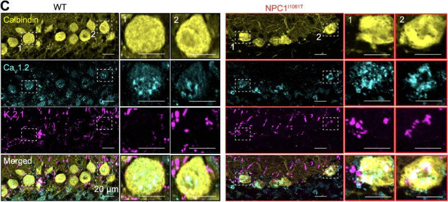 Anti-Cav1.2 Ca2+ Channel Antibody - Image 3