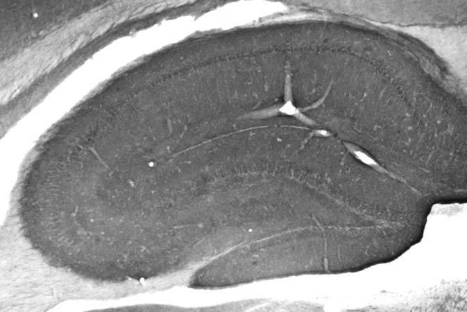 Anti-Cav1.3 Ca2+ Channel Antibody - Image 2