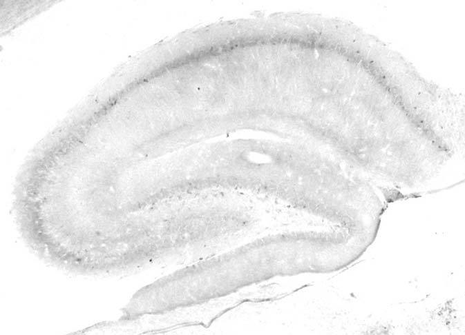 Anti-Cav1.3 Ca2+ Channel Antibody - Image 2