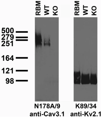 Anti-Cav3.1 Ca2+ Channel Antibody - Image 3